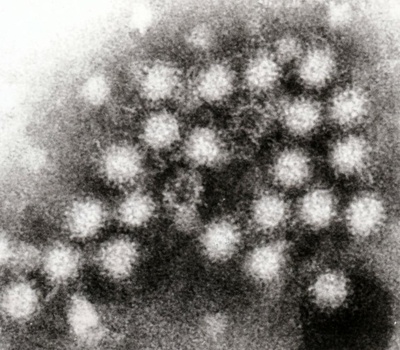 Cover image for Babson College Hit By Norovirus