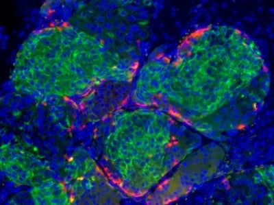 Cover image for Doug Melton Stem Cells