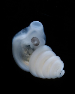 Cover image for Med School Study Explores Genitalia Formation