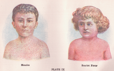 Cover image for I Can’t Believe I Genuinely Got Scarlet Fever in the Year of Our Lord Two Thousand Eighteen