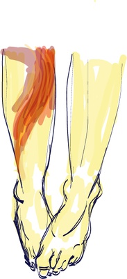Cover image for How to Treat a Burn