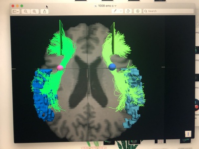 Cover image for a brain