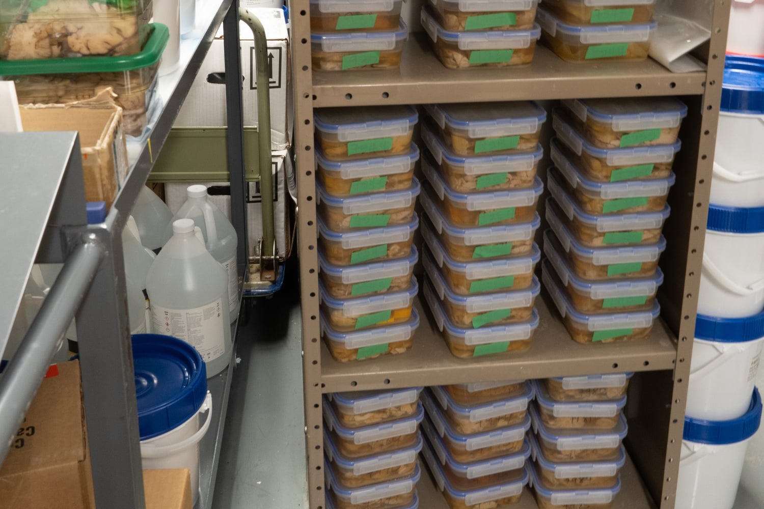 The brain collection at the Harvard Brain Tissue Resource Center holds nearly 10,000 brains which are used for research around the country.