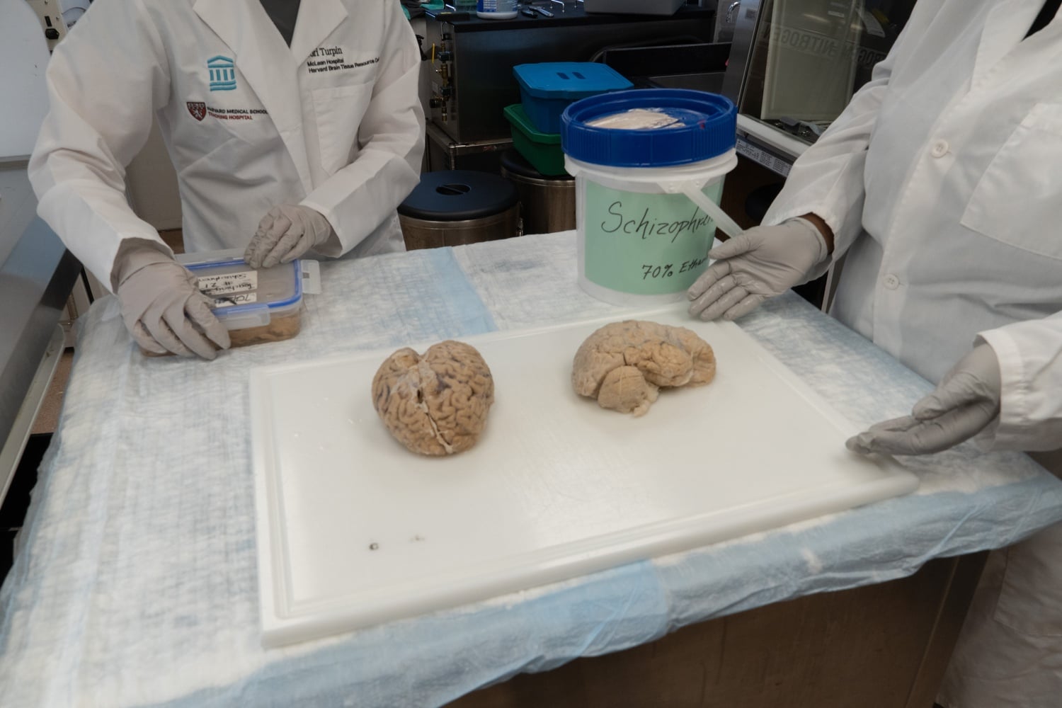 Brains used for demonstrations to visitors at McLean Hospital. One of the brains belonged to a donor with schizophrenia, while the other had Huntington’s disease.