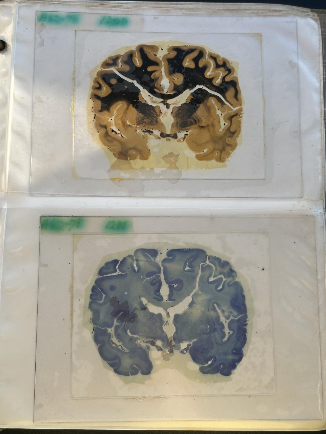 Berretta has a binder of slides from Yakovlev's brain collection, stained in yellow and blue.